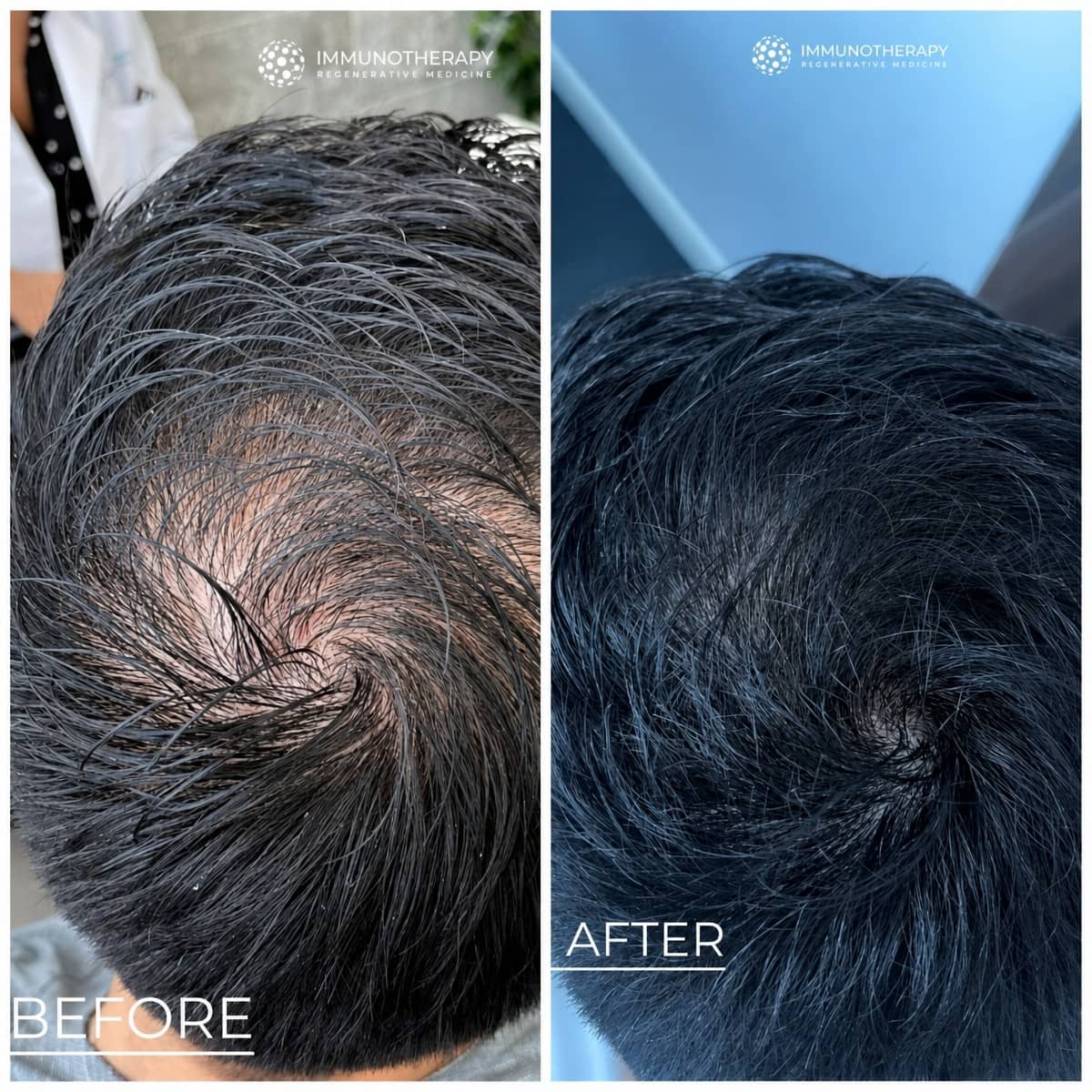 Case 18030 - stem cell hair treatment