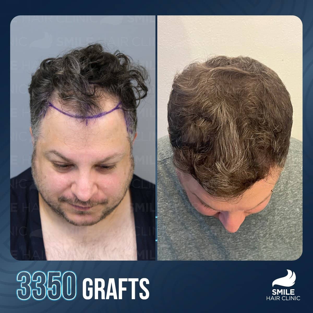 Case 18234 - result