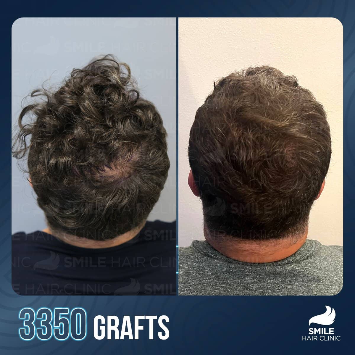 Case 18236 - before and after