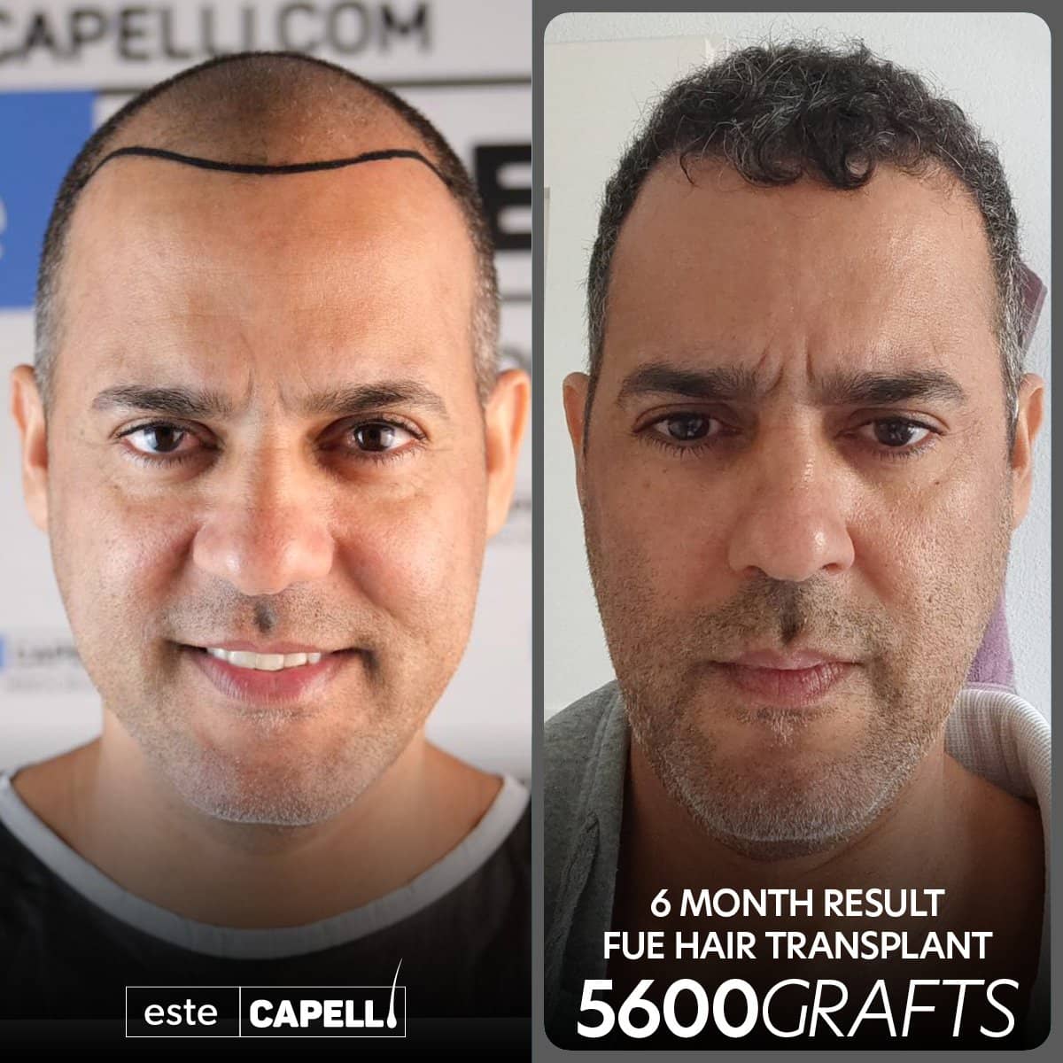 Case 18247 - result