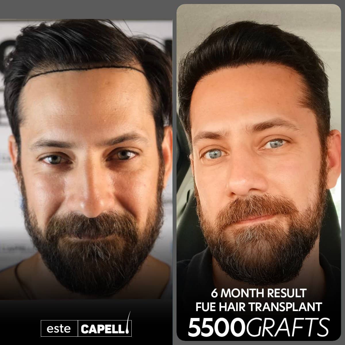 Case 18253 - result