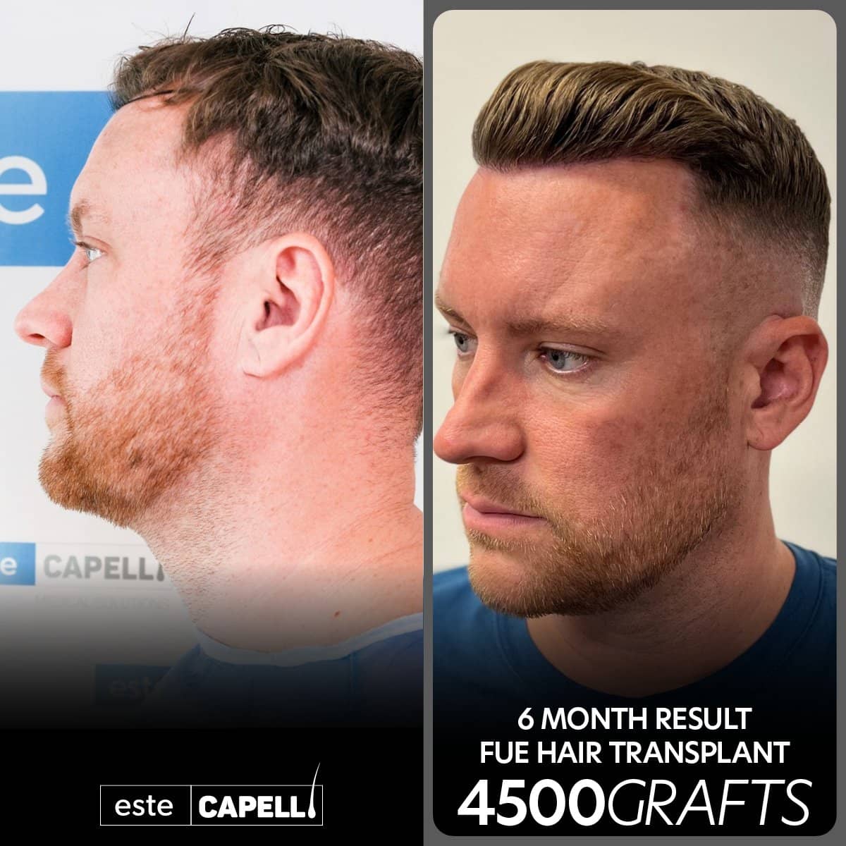 Case 18258 - result