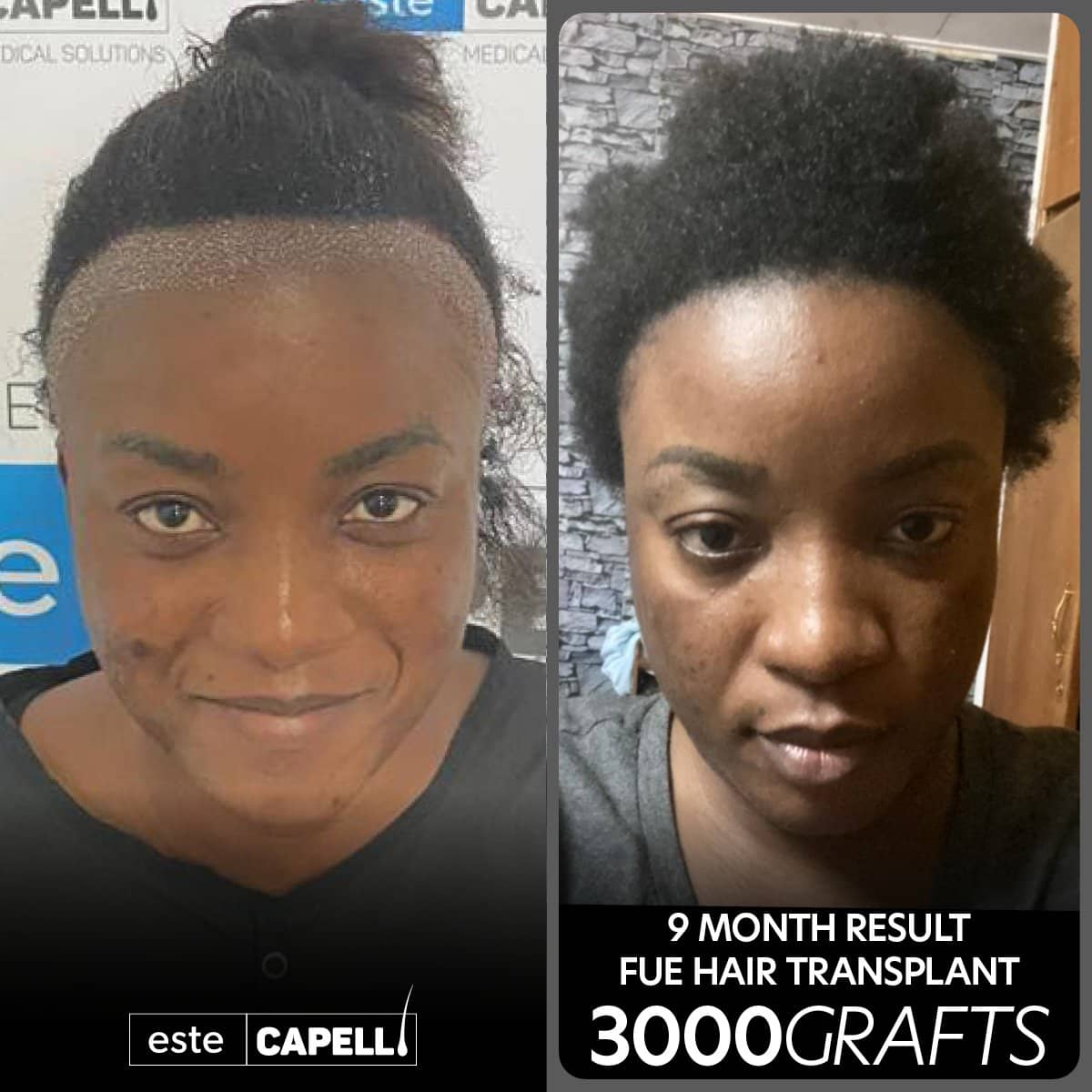 Case 18260 - result