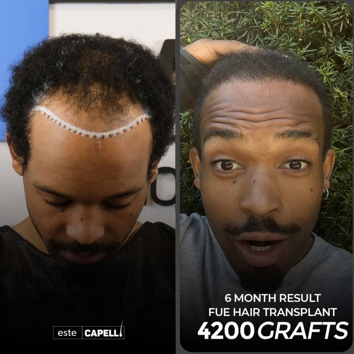 Case 18266 - before and after