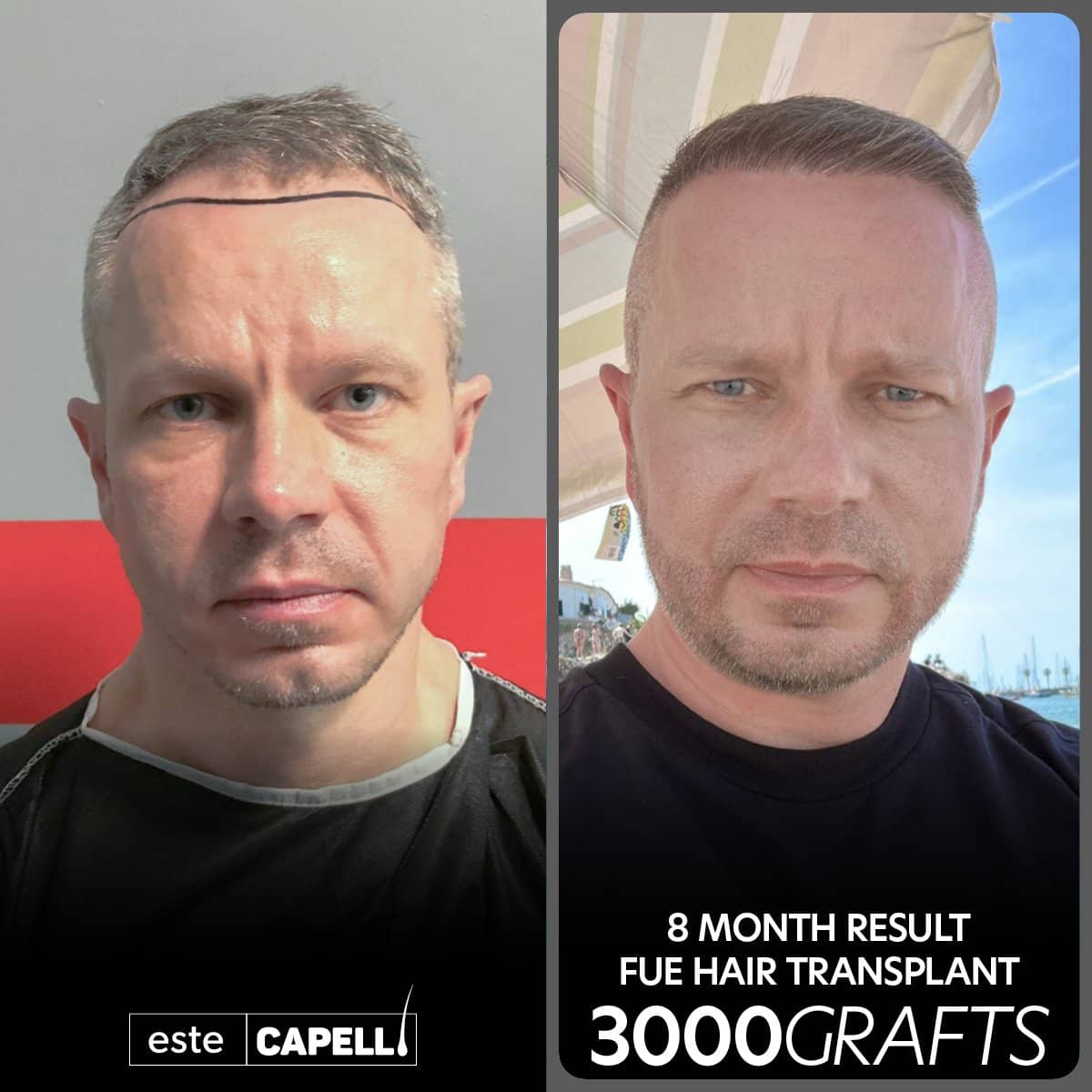Case 18267 - result