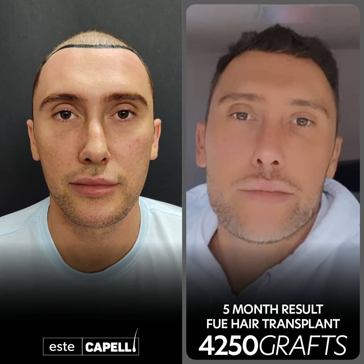 Case 18268 - result