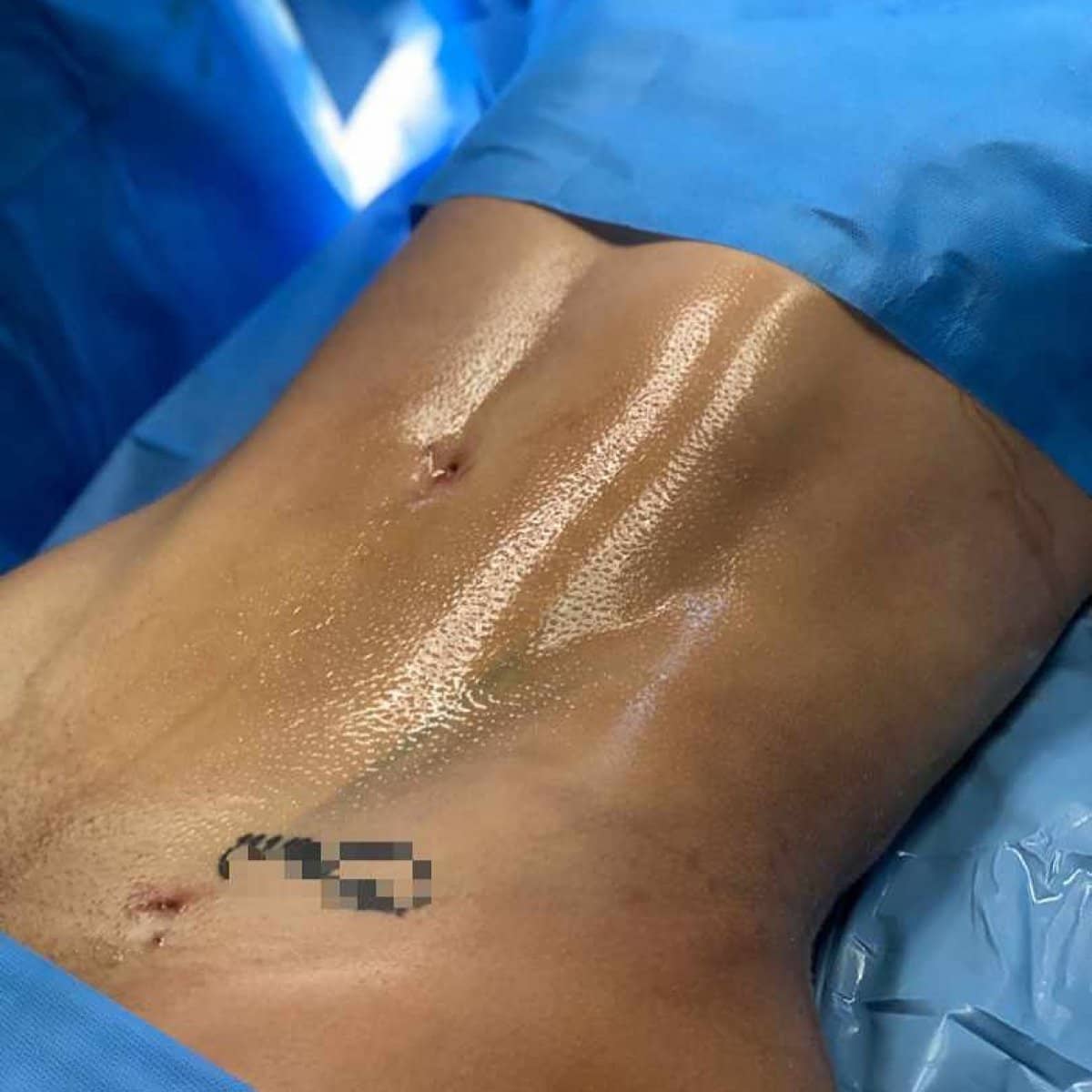 Case 18697 - before and after