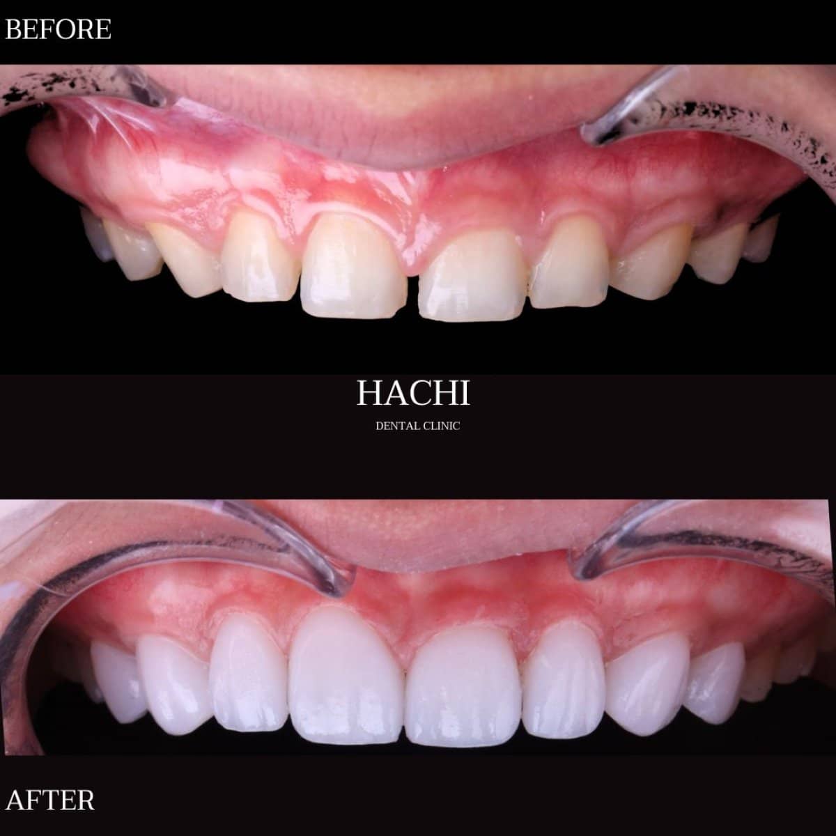Case 19503 - results