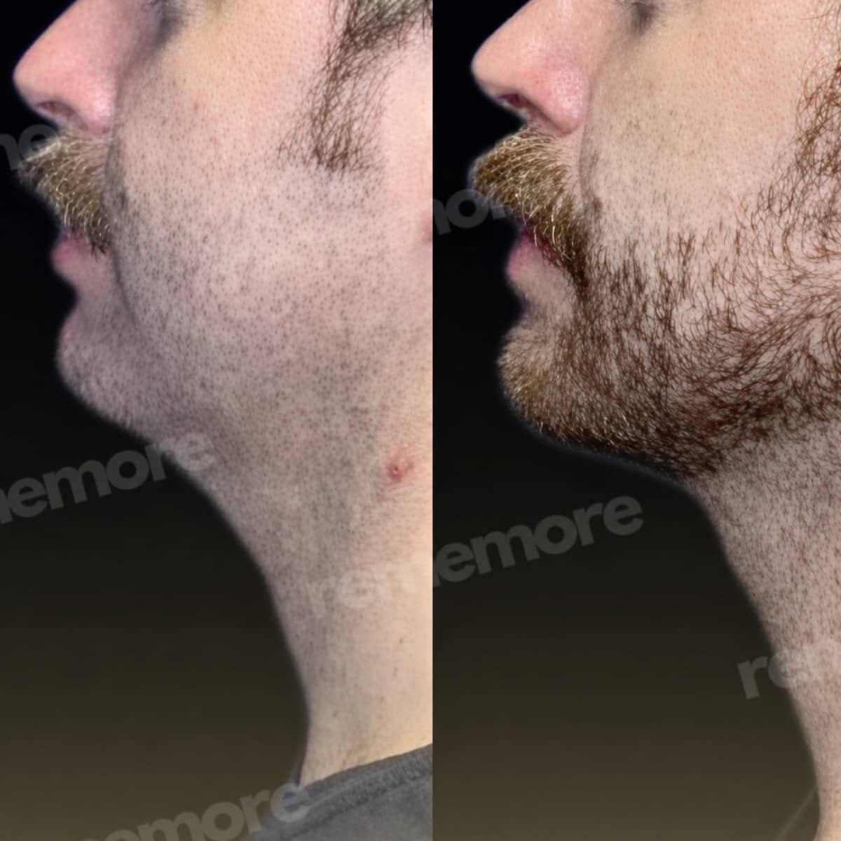 Case 19750 - jaw shaping