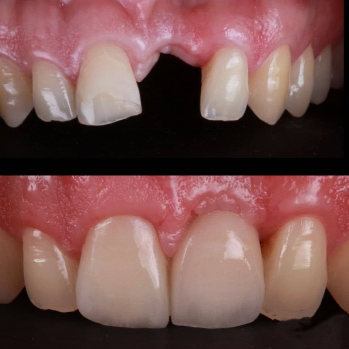 Case 19812 - dental implant