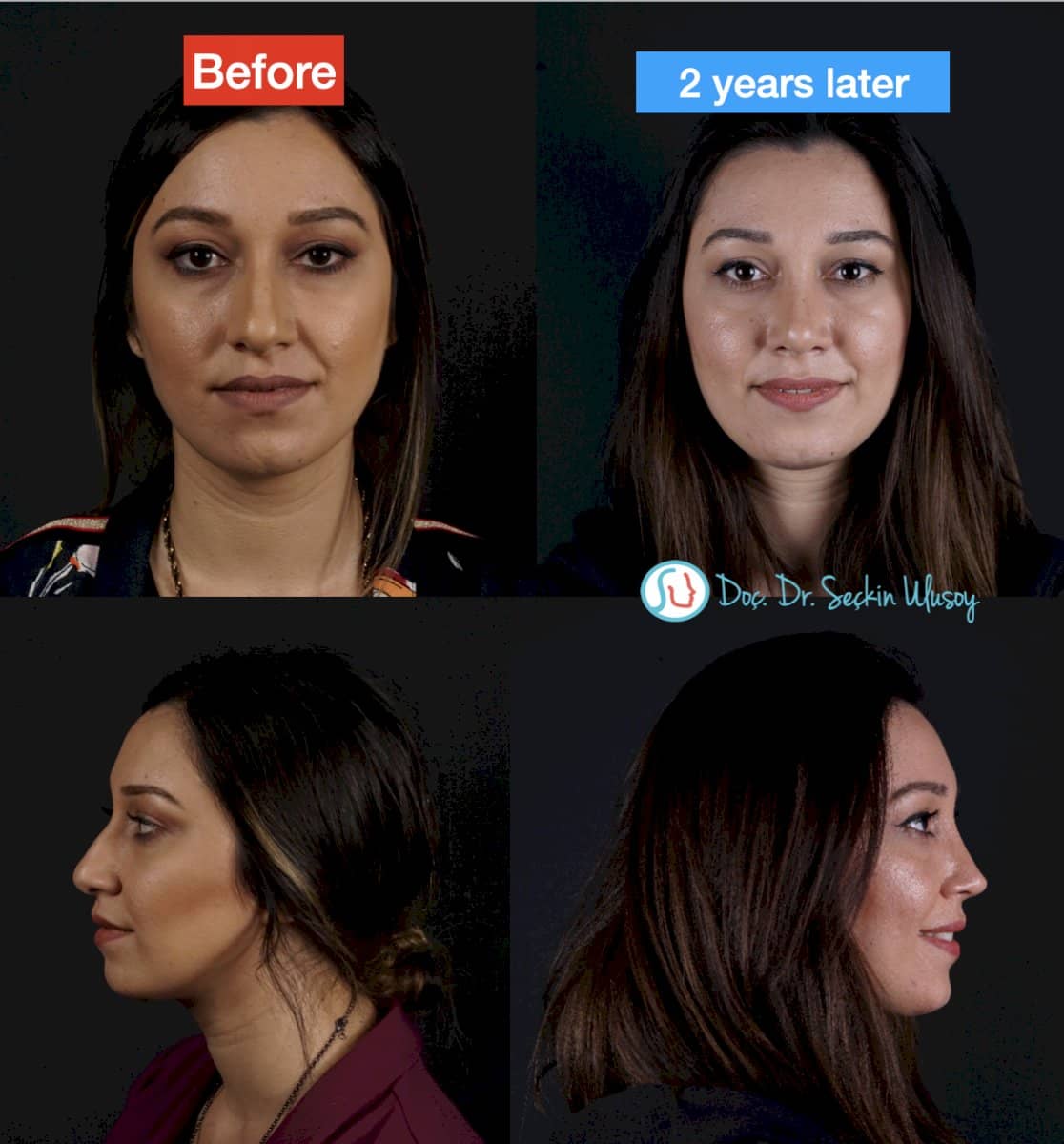 Case 19873 - before and after
