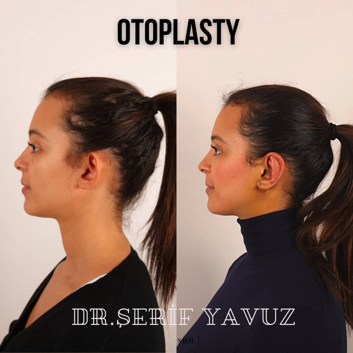 Case 20001 - results