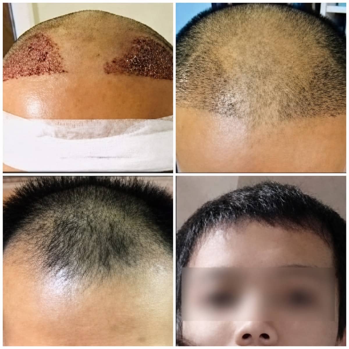 Case 20151 - results