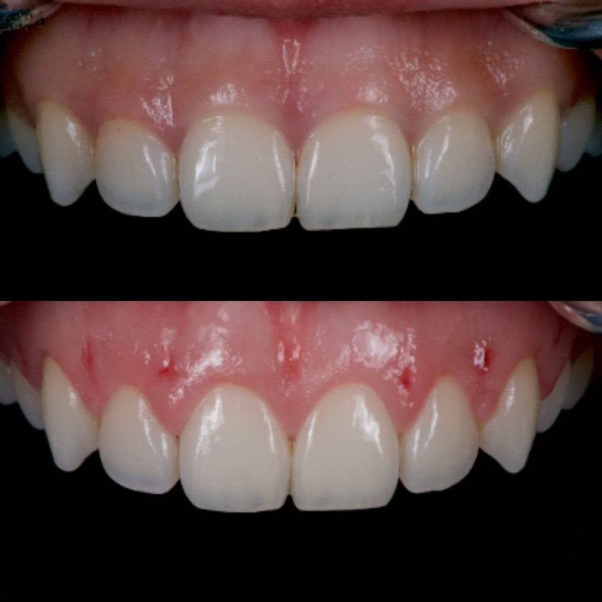Case 20663 - gum surgery