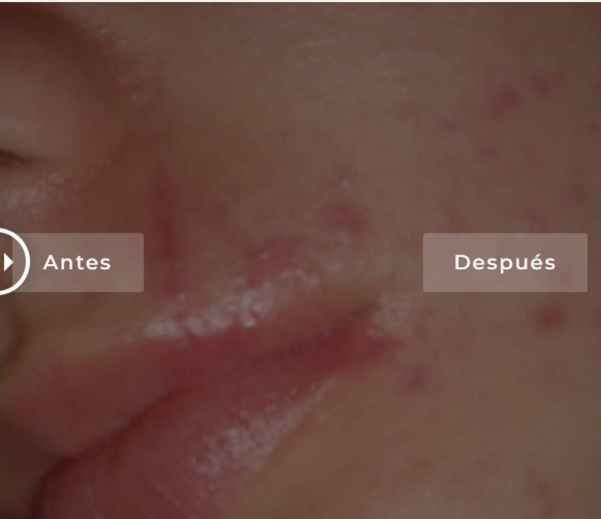 Case 20868 - results on face