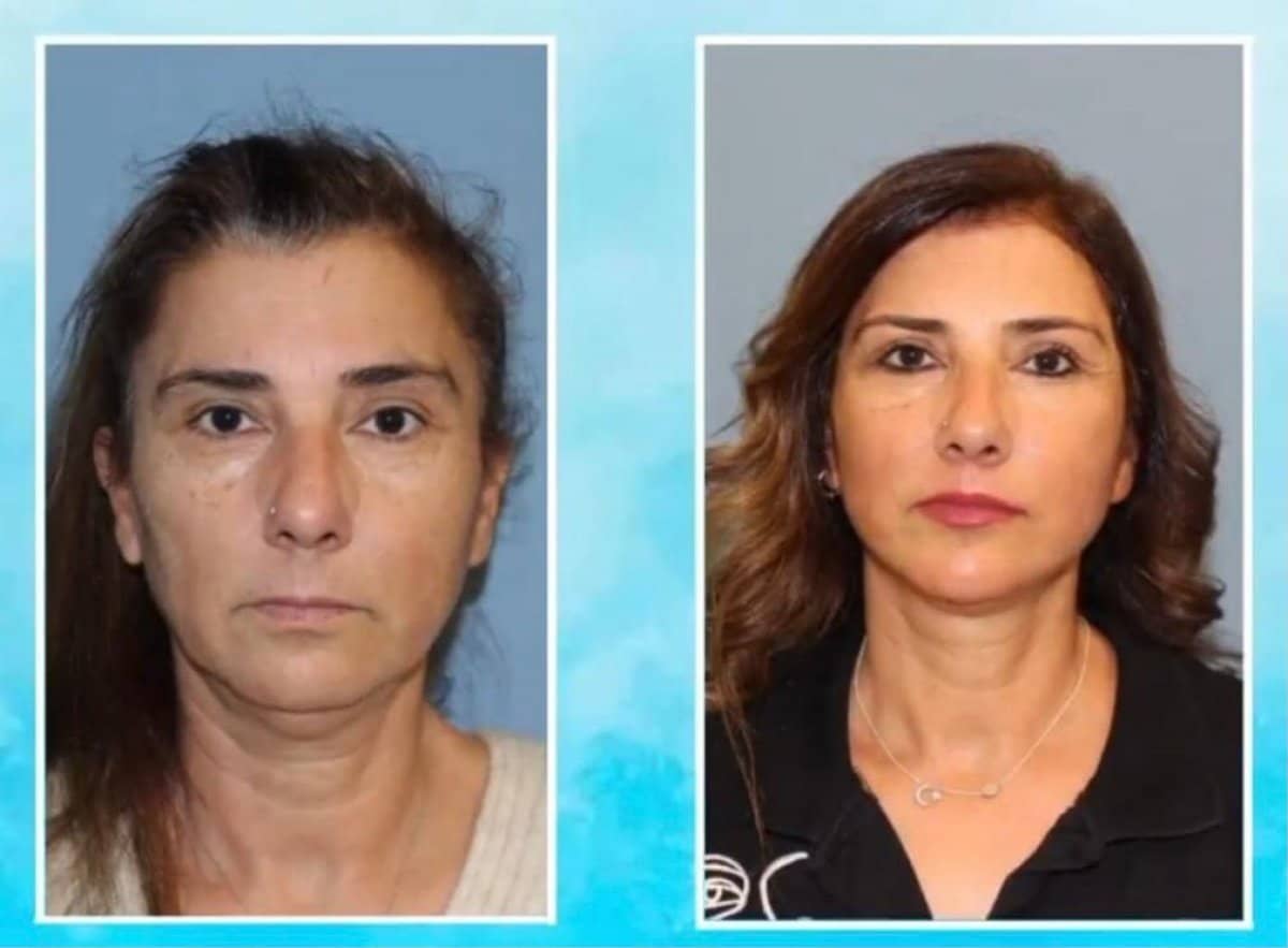 Case 21117 - blepharoplasty