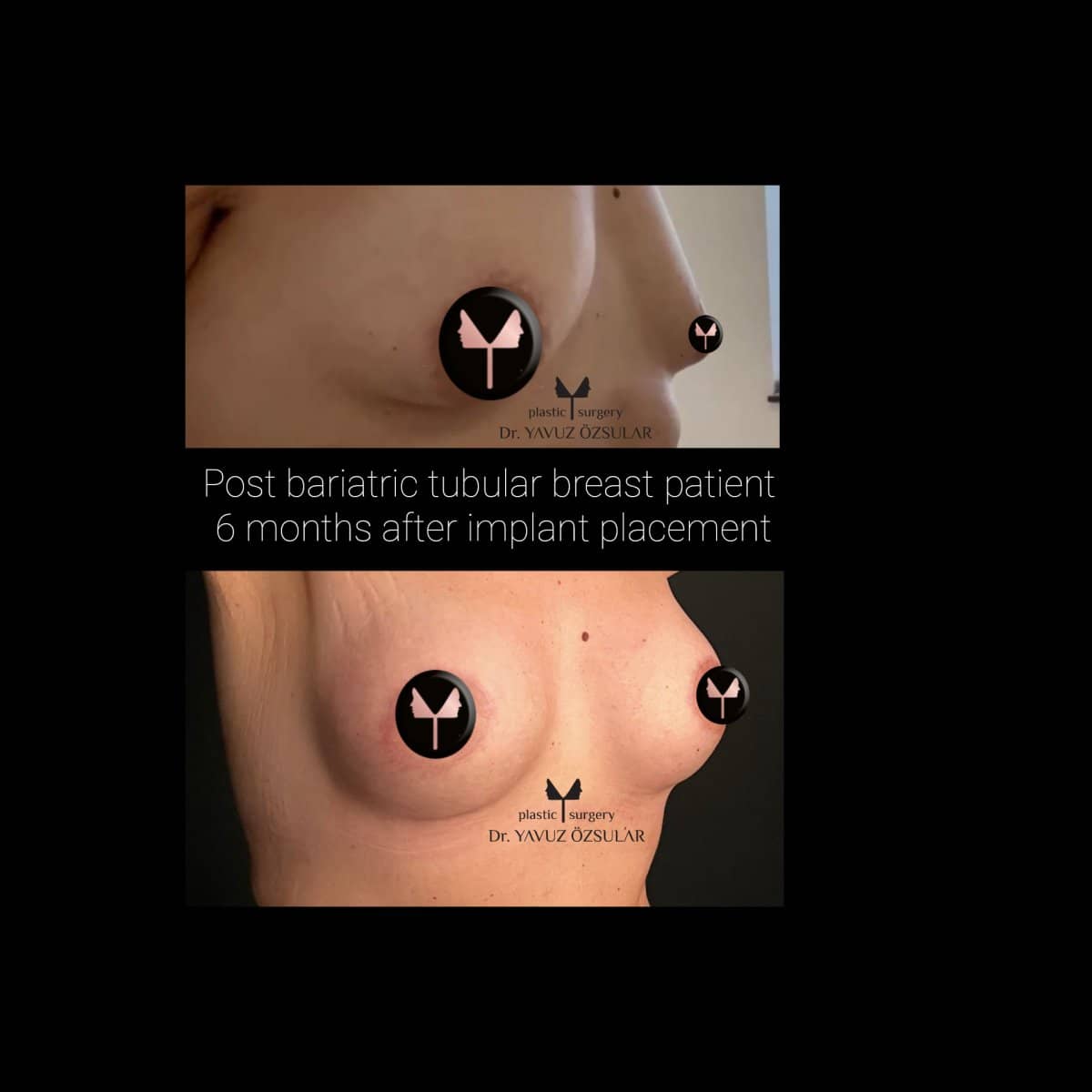Case 21161 - results