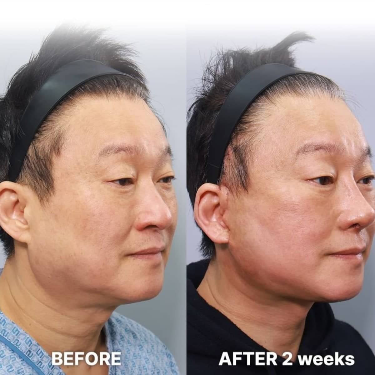 Case 21235 - results