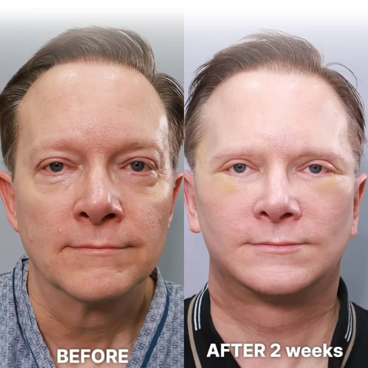 Case 21251 - results