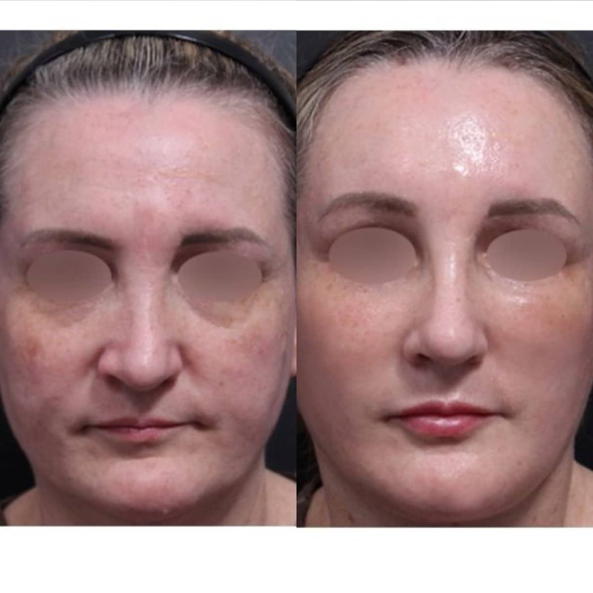 Case 21252 - results