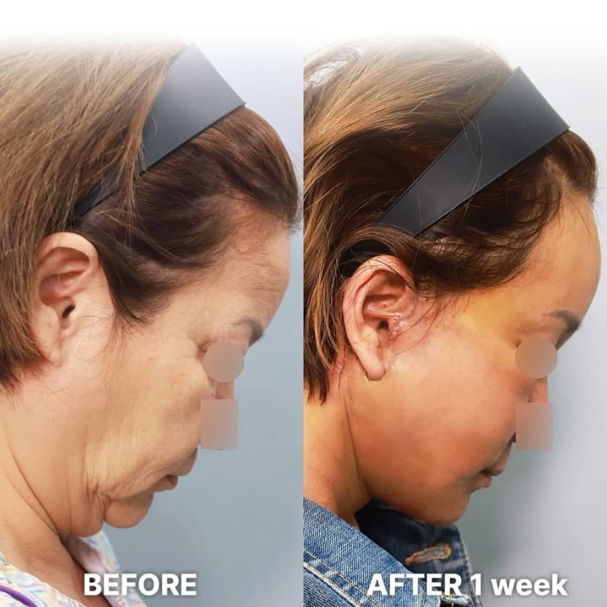 Case 21254 - 1 week