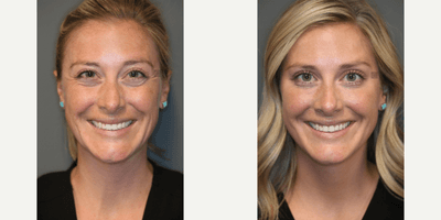 Case 6459 - Botox