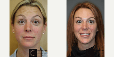 Case 6583 - Botox