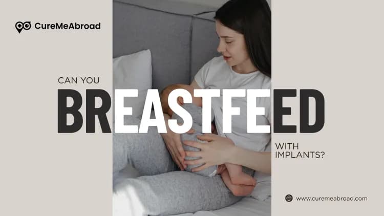 Can You Breastfeed with Implants? What Every New Mom Should Know