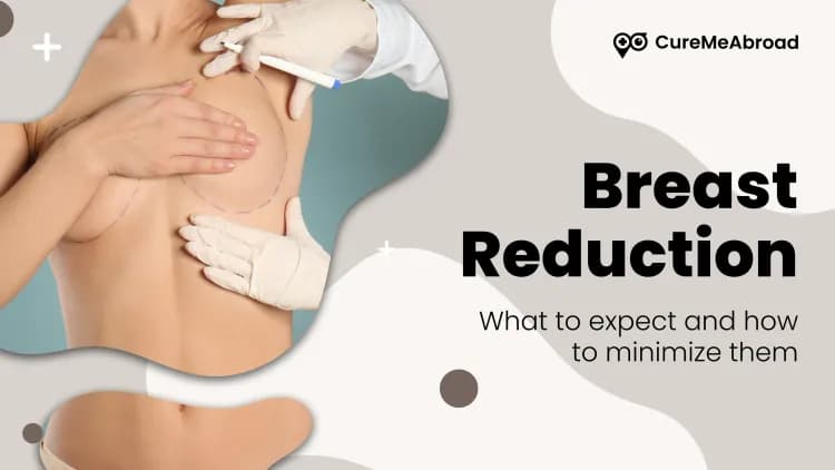 Breast Reduction Scars: What to Expect and How to Minimize Them