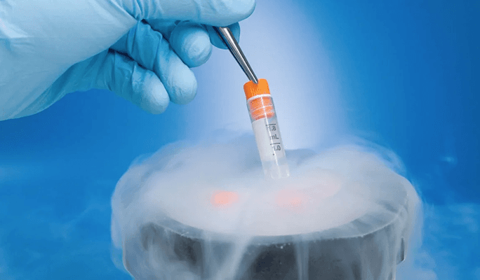 FET (Frozen Embryo Transfer)