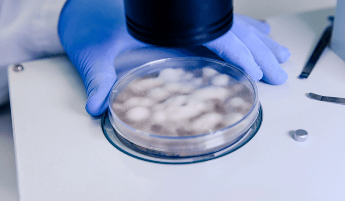 Embryo Oocyte and Sperm Cryopreservation