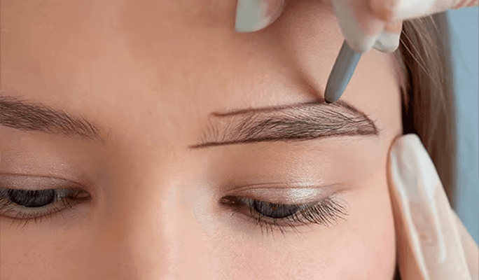 Eyebrow Hair Transplant