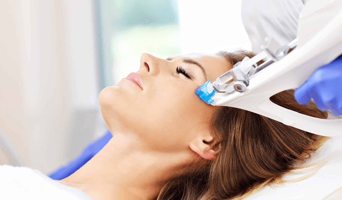 Mesotherapy for Hair Treatments