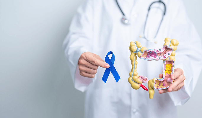 Colorectal Cancer