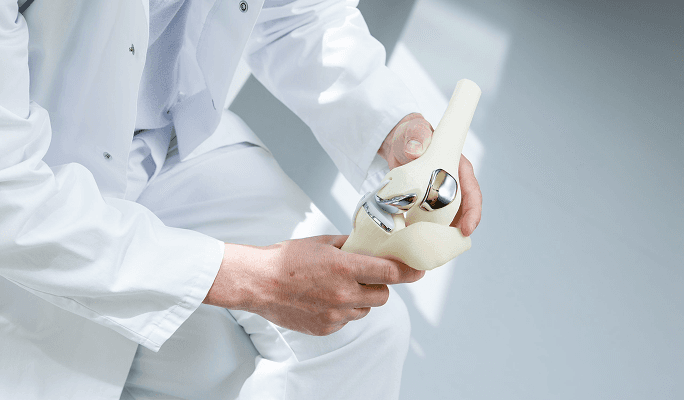 Joint Replacement Surgery (Arthroplasty)
