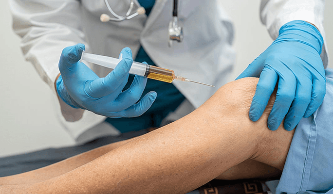 PRP Injection for Joints