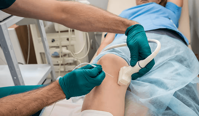 Radiofrequency Ablation