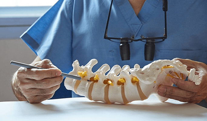 Lumbar Posterior Fusion (PF)