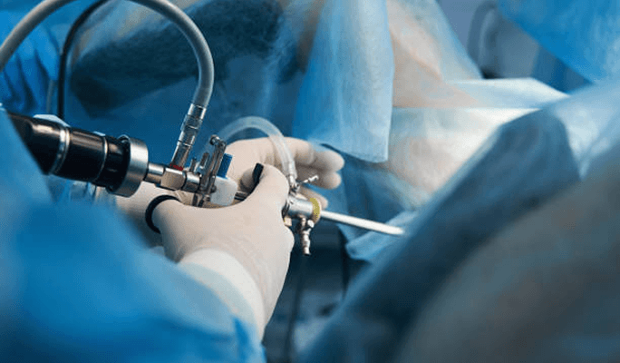 Osteoporosis Kyphoplasty