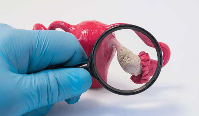 Stem Cell Treatment for Ovarian Rejuvenation