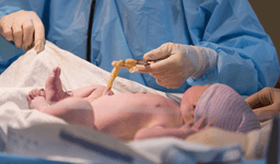 Umbilical Cord Stem Cell Therapy