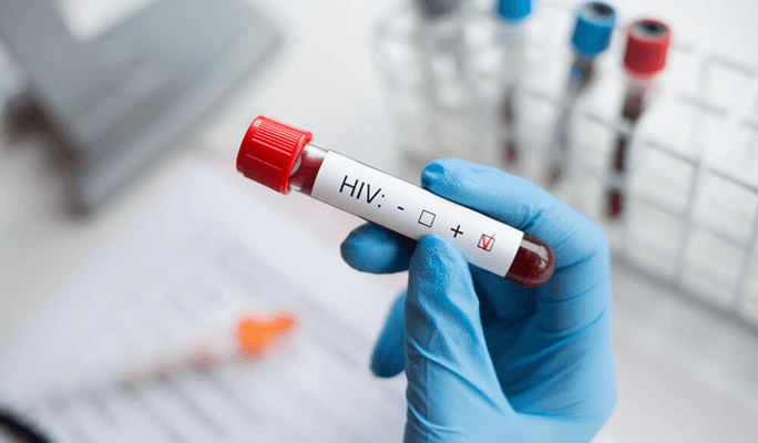 Stem Cell Treatment for AIDS and HIV