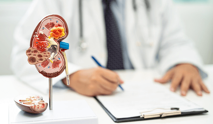 Renal Cancer Treatment