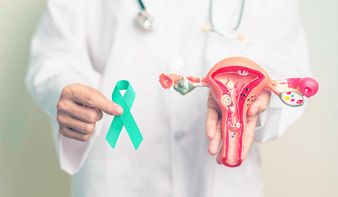 Ovarian Cancer