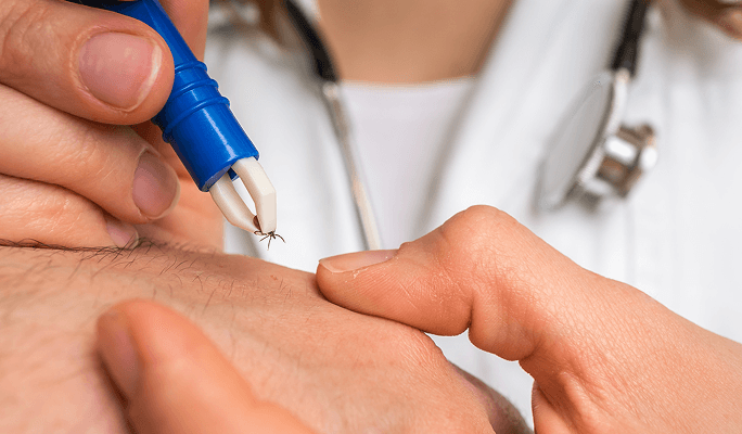 Stem Cell Therapy for Lyme Disease
