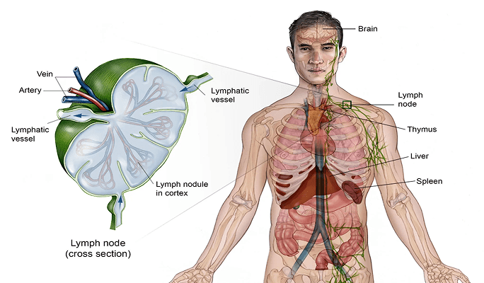Non-Hodgkin Lymphoma (NHL)