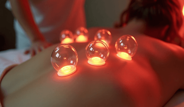 Temporary discomfort or bruising at the cupping sites