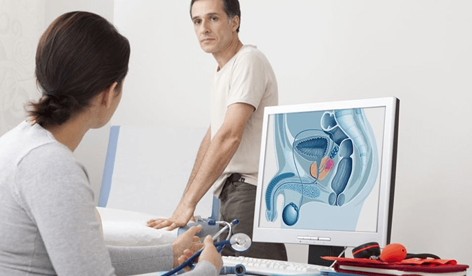 Prostate Cancer Screening for Men