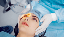 LASIK Surgery
