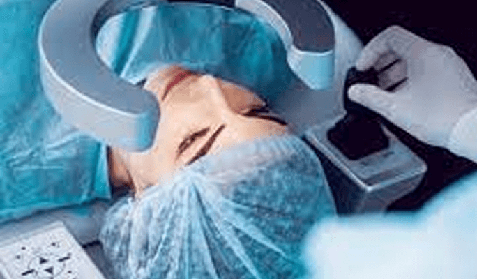PRK Laser Eye Surgery